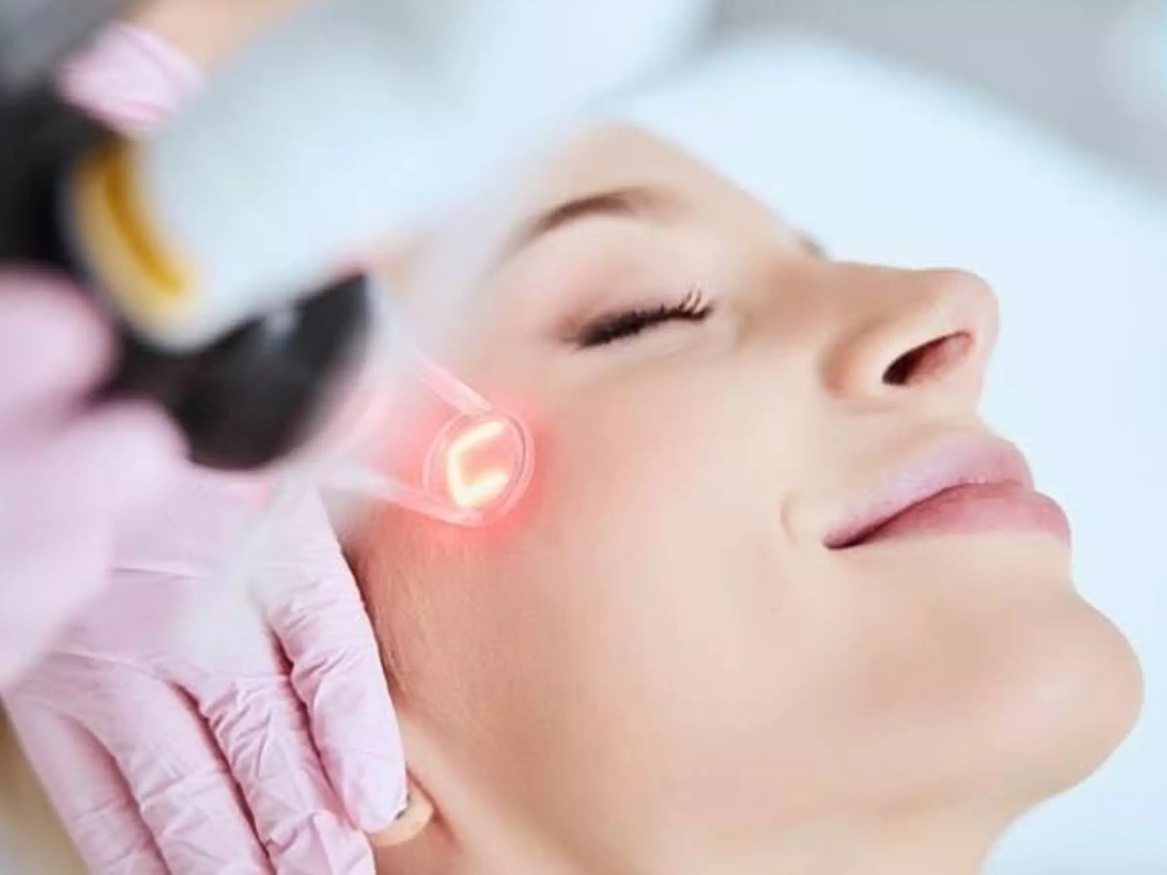 Up to 65% Off on Laser Skin Resurfacing at Elite Skin Studio