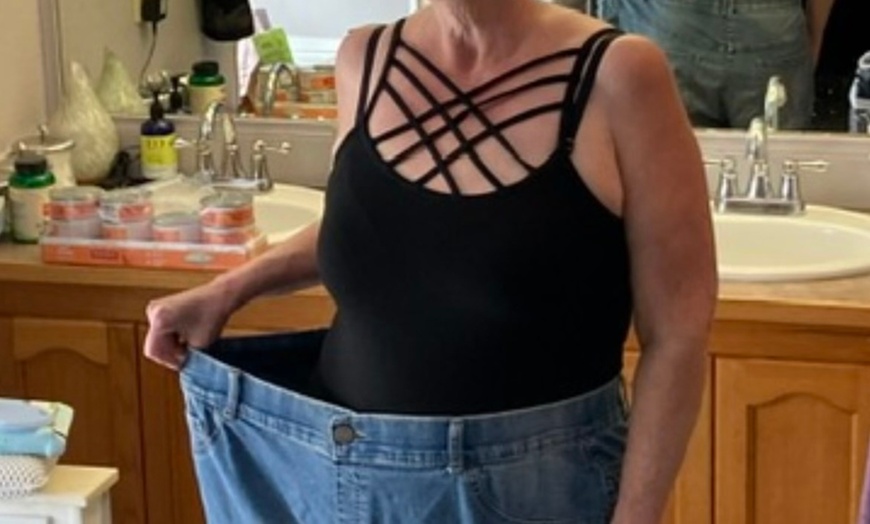 Image 4: 1, 3, or 6 Sessions of Radio Frequency Skin Tightening Treatments 