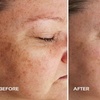 Image 4: Achieve Radiance with 6, 10, or 20 Dermalux MD Triwave LED Therapy 