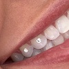 Image 2: Austrian Crystal Tooth Gems, Crystal Butterfly, Silver Bracelet & More
