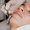Image 9: Get Express Facial with LED or Microdermabrasion Custom Facials