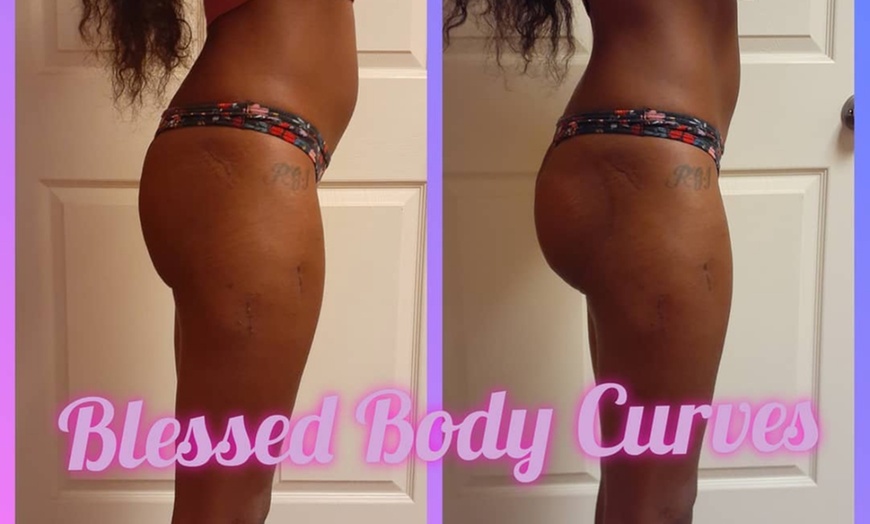 Image 2: Up to 84% Off on Lipo - Non-Invasive Laser-iLipo at Blessed Body Curves