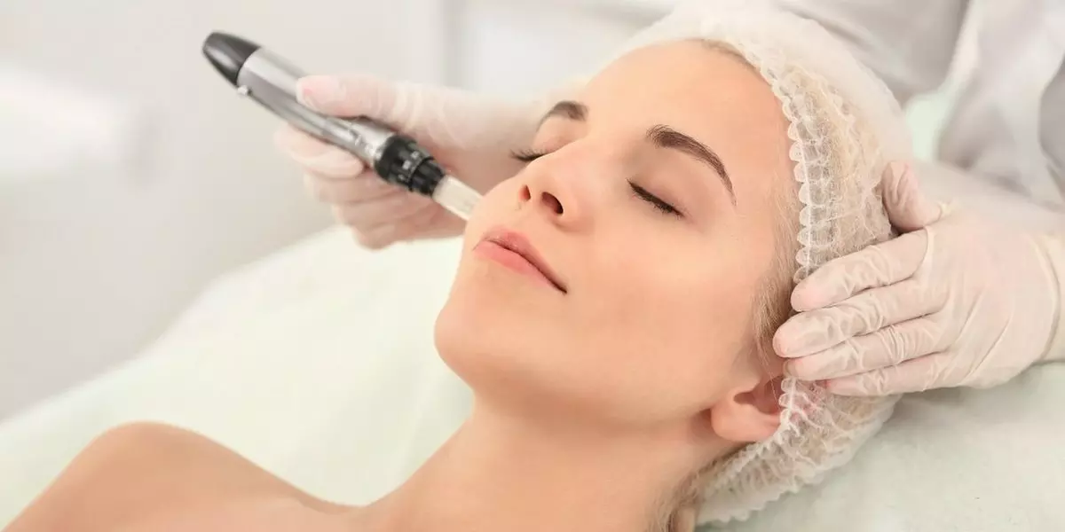$175 for One Microneedling Treatment at Pristine Aesthetics ($350 Value) - Primary Image