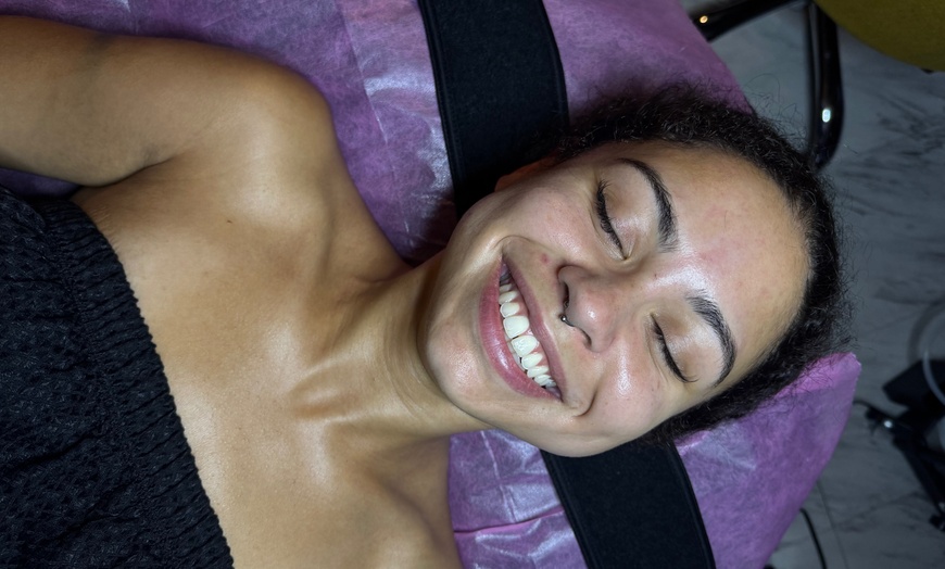 Image 3: 60-Minute Microdermabrasion Facial for Glowing, Healthier Skin