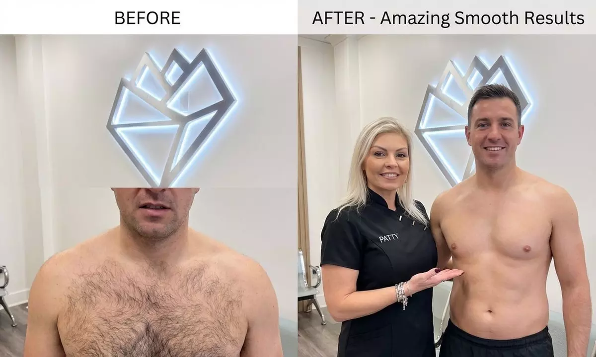 Smooth & Silky Skin With Women's Brazilian Wax or Sugar Wax Services