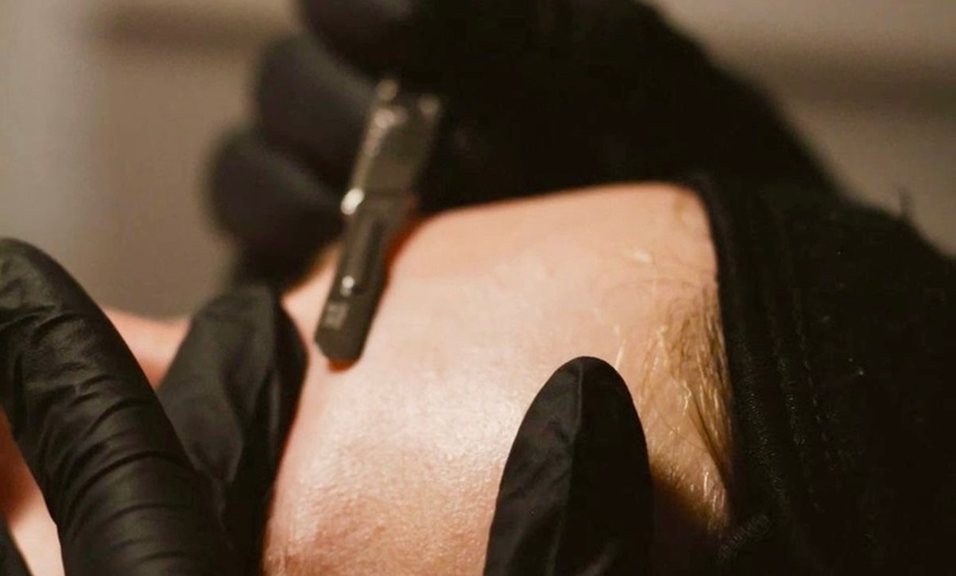Image 2: Dermaplaning and Pumpkin Enzyme Peel Treatments for Skin Renewal