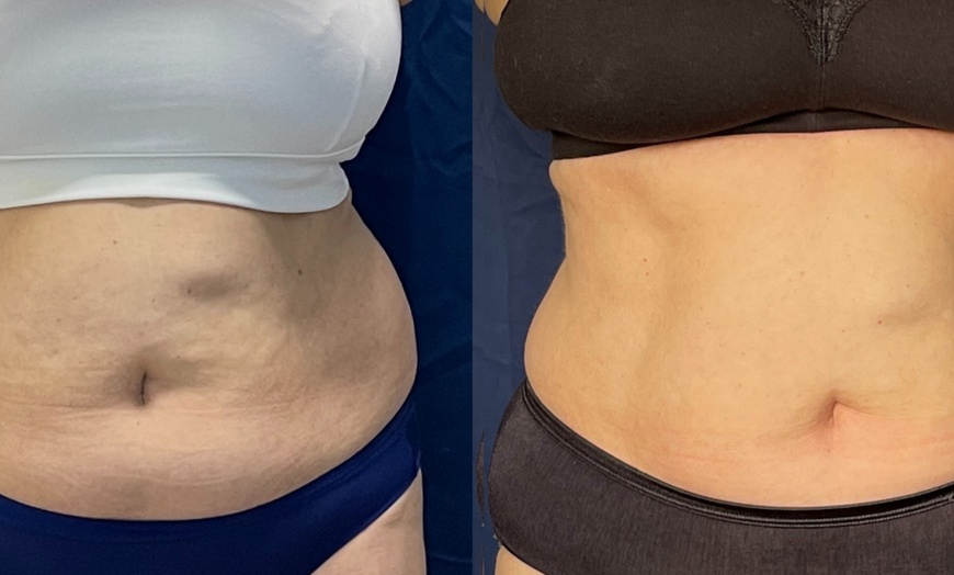 Image 1: Get EM Sculpt Abs/Buttocks/Thighs in Just 30 Minutes at Harmony In Health (Up to 74% Off)