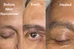 Up to 69% Off on Permanent Makeup at The Makeup Monk - Second Medium