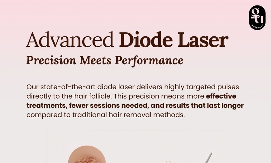 Image 3: Get Smooth with Six Laser Hair Removal on Small, Medium, Large, or Extra Large Areas (Up to 63% Off 