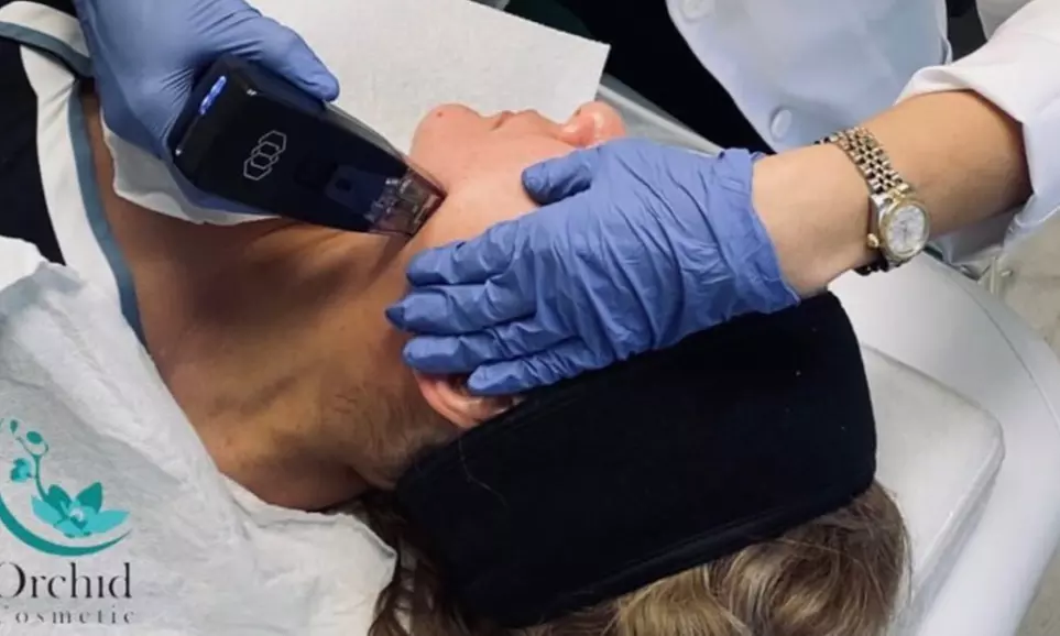 One Morpheus Eight Facial Rejuvenation Treatment at Orchid Cosmetic (Up to 7% Off) - Primary Image