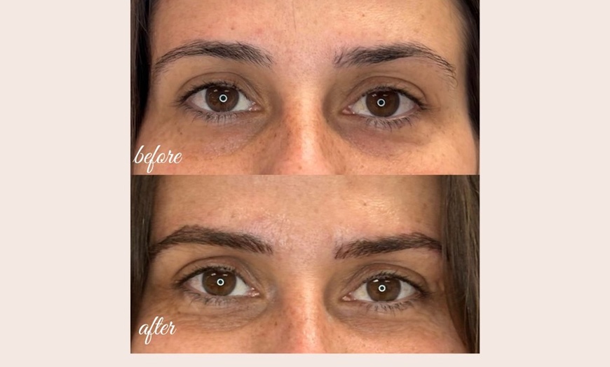 Image 6: Defined Brows & Lips with Microblading or Lip Blush