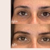 Image 6: Defined Brows & Lips with Microblading or Lip Blush