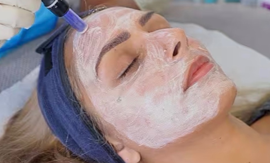 Image 4: Up to 35% Off on Facial at Hang's Spa