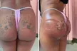 Experience Extreme Body Sculpting's innovative nonsurgical butt lifts with up to 56% off for stunning results - Second Medium