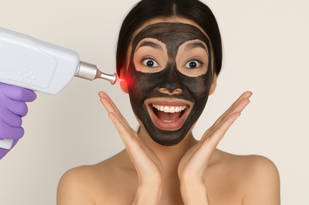 One Session of Carbon Laser Peel - LUX LOOK Beauty & Laser Clinic