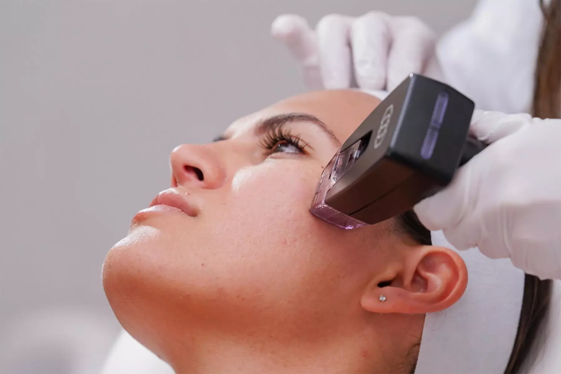 1, 2 or 3 55-Min Morpheus8 Sessions with Optional HIFU for Face & Neck