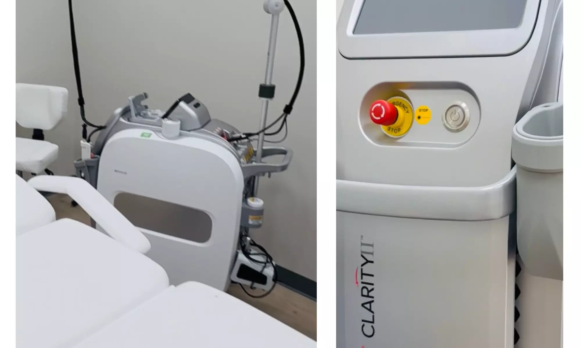 Get Smooth Skin with Laser Hair Removal Sessions