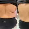Image 3: Up to 62% Off on Fat Reduction - Non-Branded at Beauty By Bear