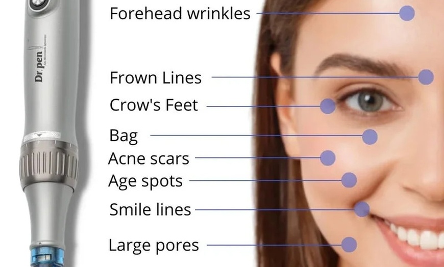 Image 2: Up to 60% Off on Micro-Needling at SKINOVA Beauty and Laser Clinic