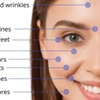 Image 2: Up to 60% Off on Micro-Needling at SKINOVA Beauty and Laser Clinic