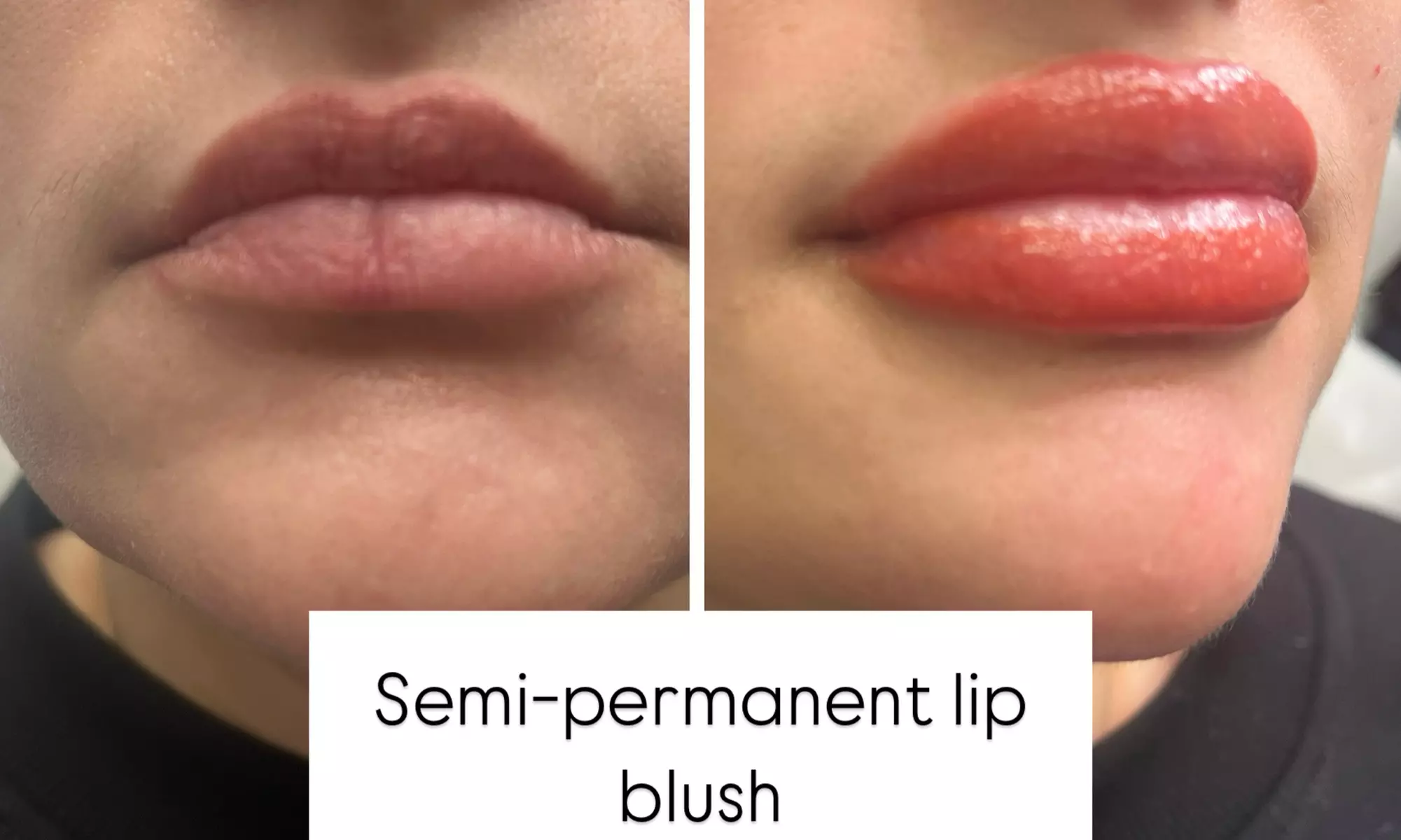 Discover Variety of Cosmetic Services for a Complete Glow-up