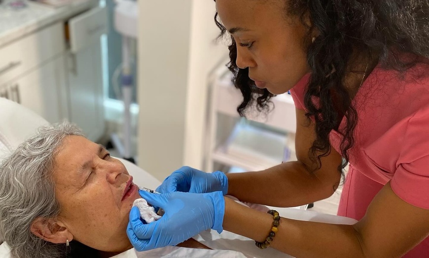 Image 1: Boost Lip Volume with One Full Syringe of Lip Filler 