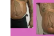 Get Total Body Sculpt, Peach Perfection, / Mommy Makeover Glow Package @ToptierBeautyBody spa (Up to 70% Off) - Second Medium