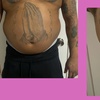 Image 3: Get Total Body Sculpt, Peach Perfection, / Mommy Makeover Glow Package 