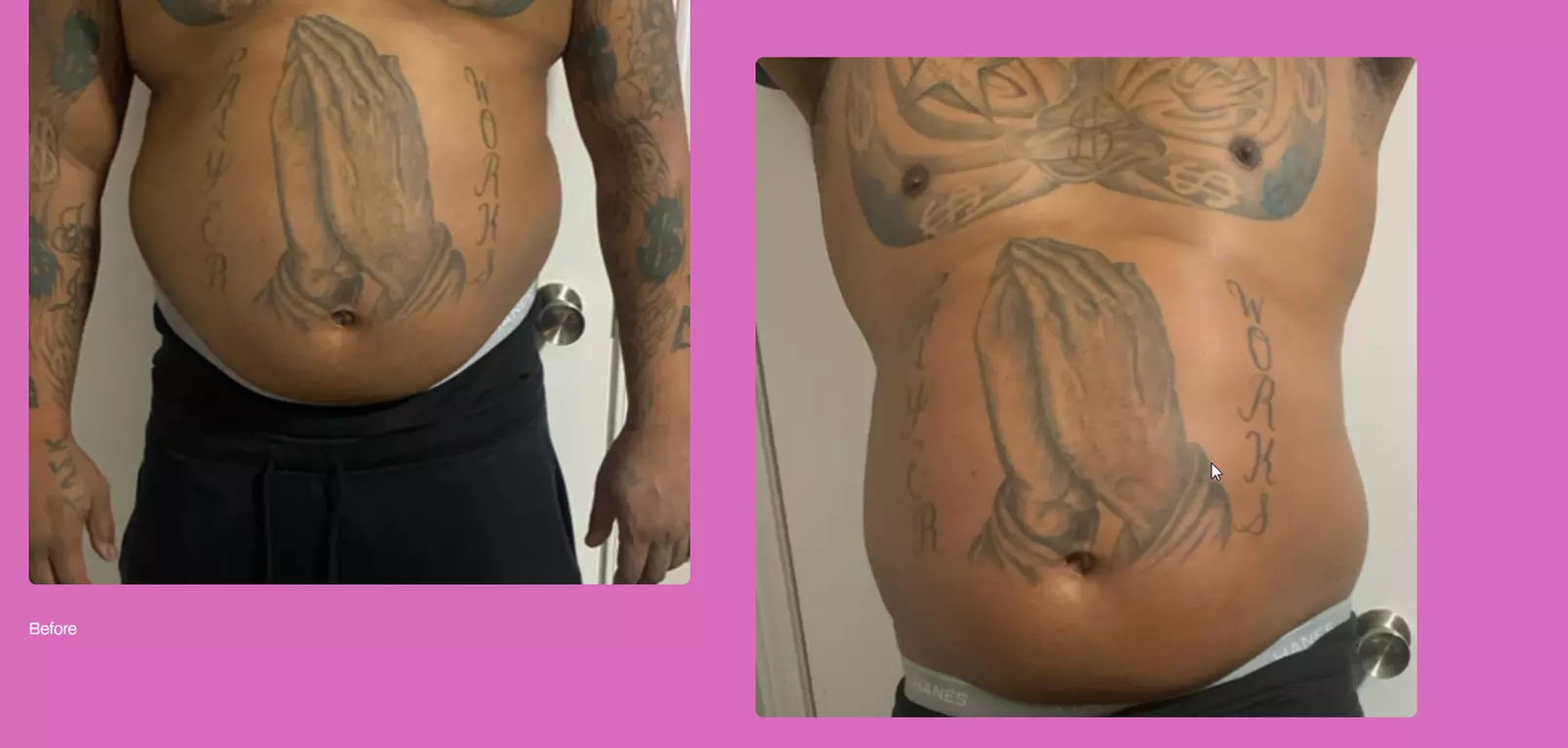 Get Total Body Sculpt, Peach Perfection, / Mommy Makeover Glow Package