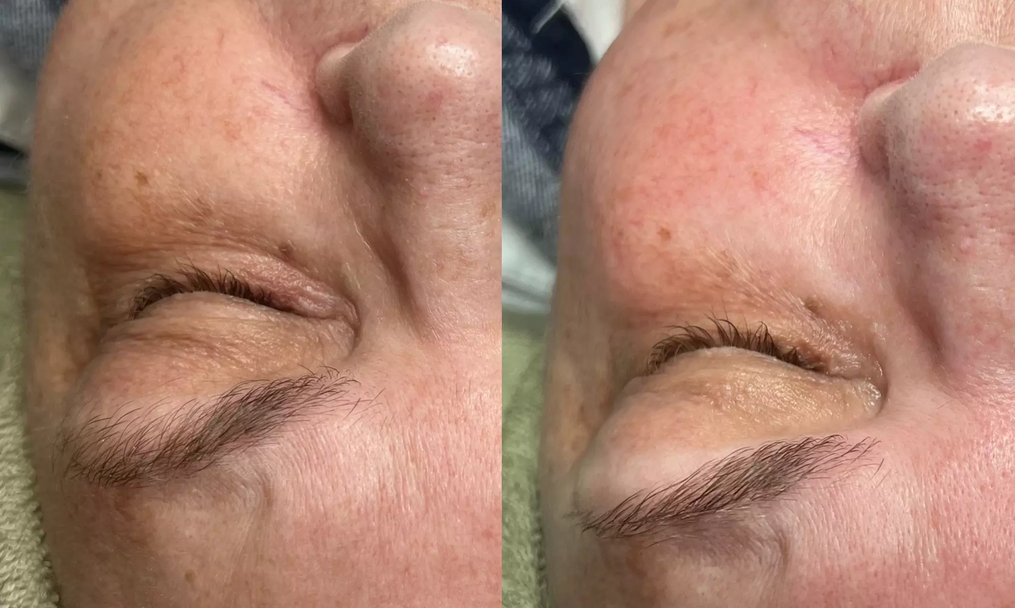 Up to 21% Off on Anti-Aging Facial at Skin Glow Studio & Moore - Primary Image