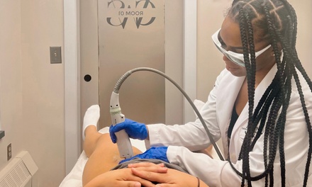 Six Laser Hair Removal Sessions on One Small Area + 1 Free Touch-Up - Genesis Wellness Spa