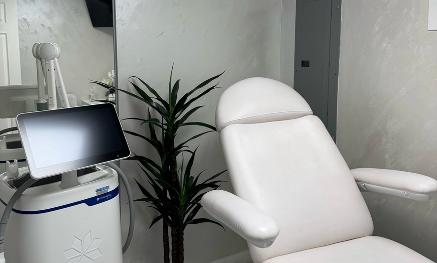 Image 4: Revanesse Versa Lip Filler at Manhattan Laser Medical Aesthetic Clinic