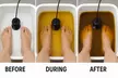 Discover Revitalization with Ionic Detox Foot Bath for One Person at La Vida Wellness Center ( Up to 30% Off ) - Second Medium