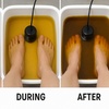 Image 2: Relax and Rebalance: Ionic Detox Foot Bath for One Person