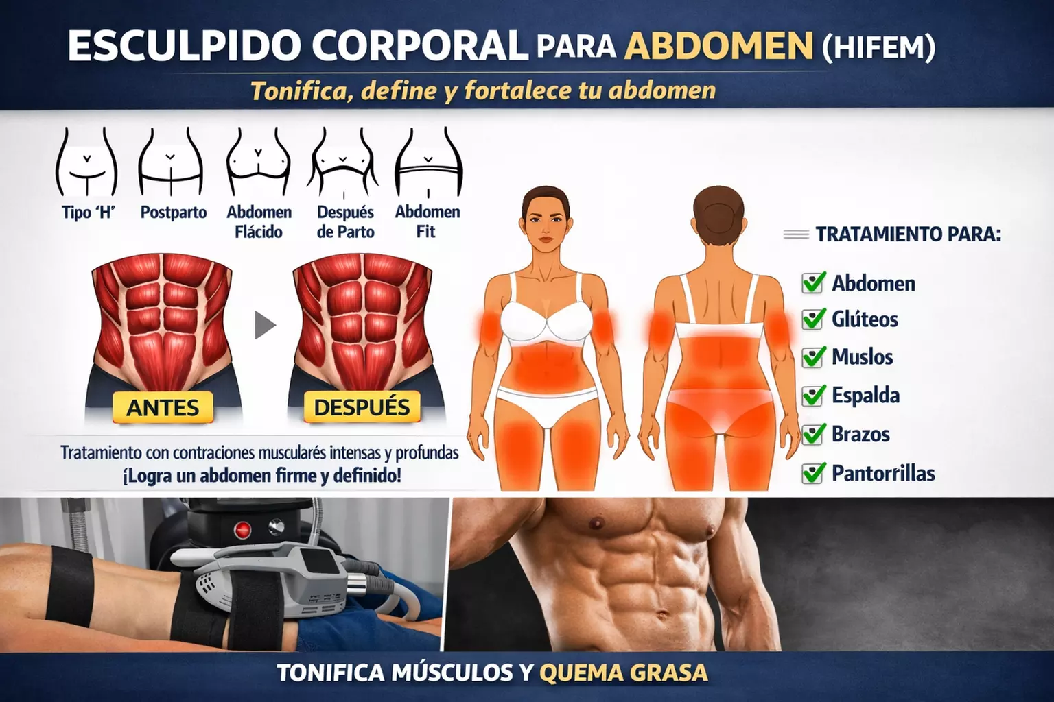 1, 4 u 8 sesiones de tratamiento de alta intensidad en zona a elegir