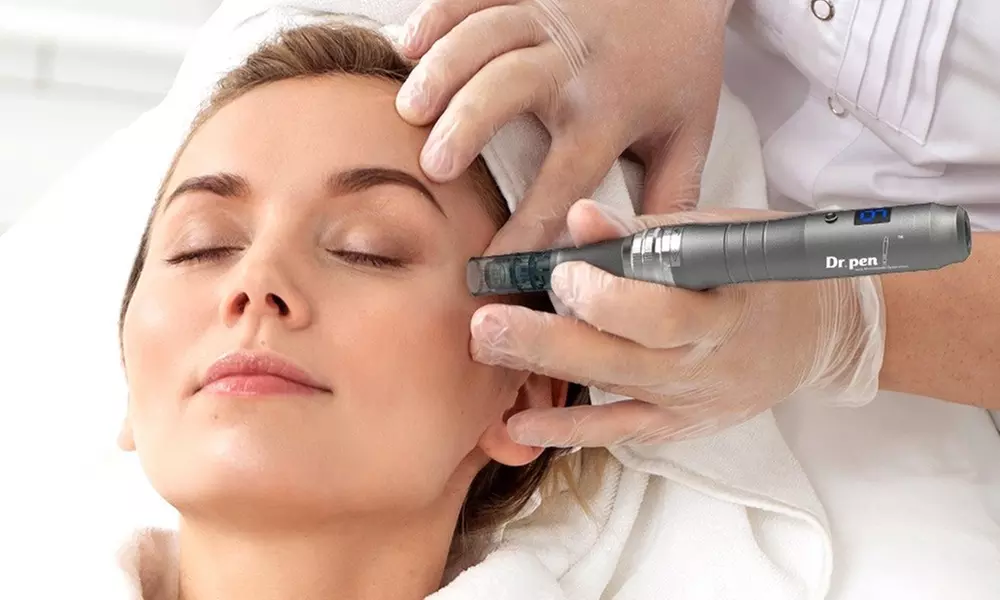 Revitalize Your Skin with One or Two Micro-Needling Treatments