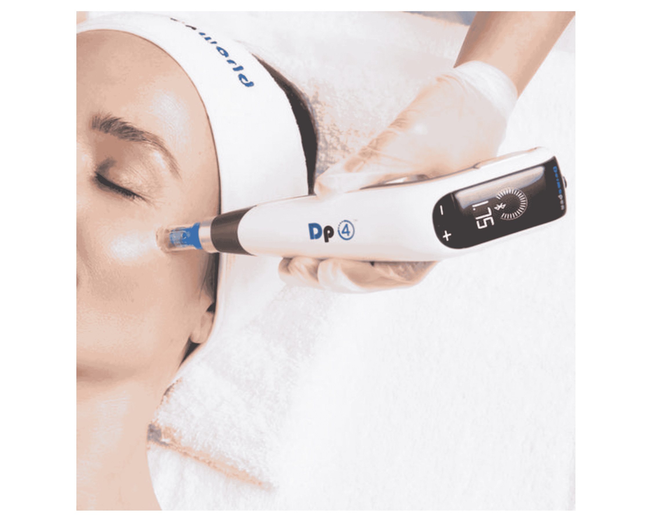 Medical Grade Microneedling Session