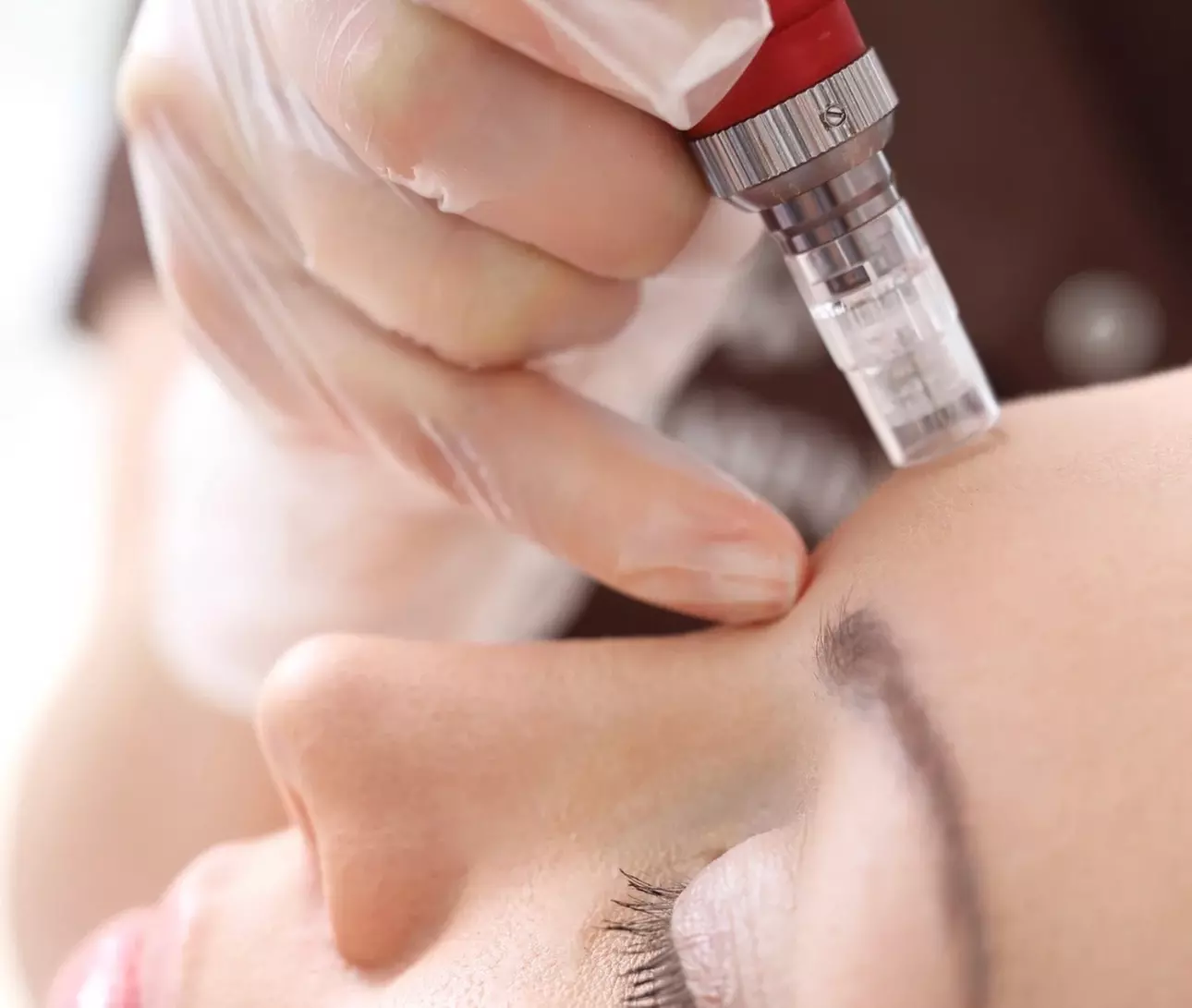 Microneedling Facial – Intro Session at Face and Grace Aesthetics (Up to 34% Off) - Primary Image