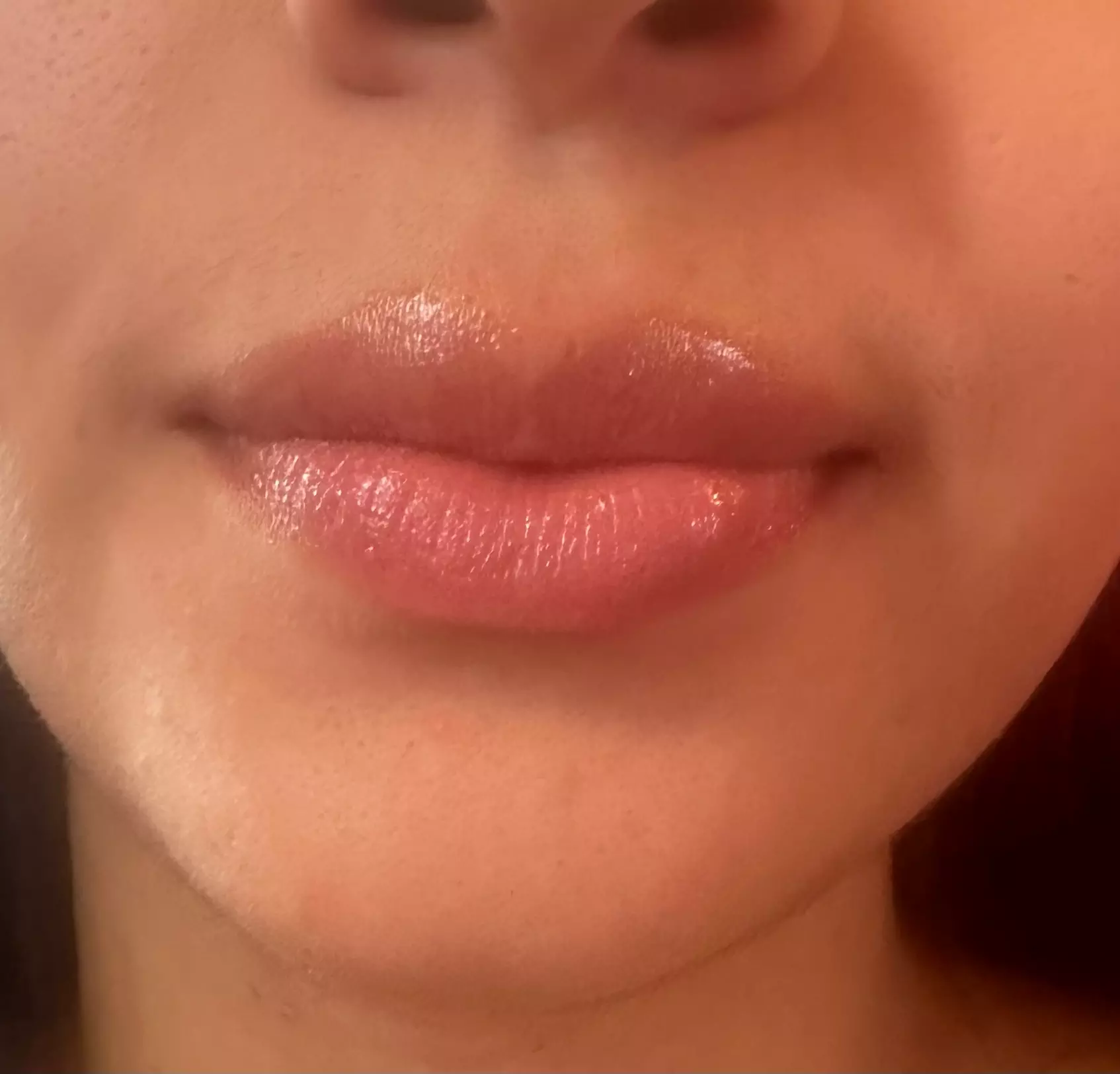 Up to 48% Off on Injection - Restylane at Bella’s beauty bar - Primary Image