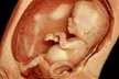 Experience Exceptional Imaging Center's Multi Visit 2D Ultrasound Package with up to 50% off for detailed prenatal memories - Second Medium