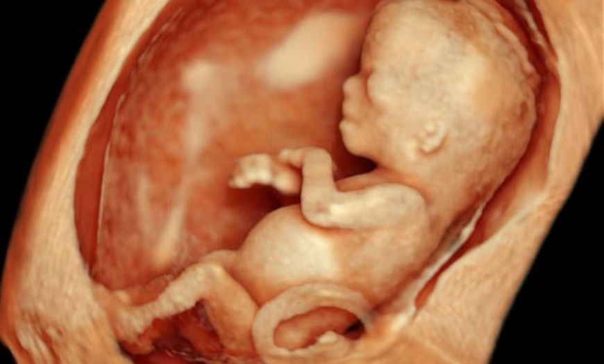 Image 2: Capture Precious Moments with Multi Visit 2D Ultrasound
