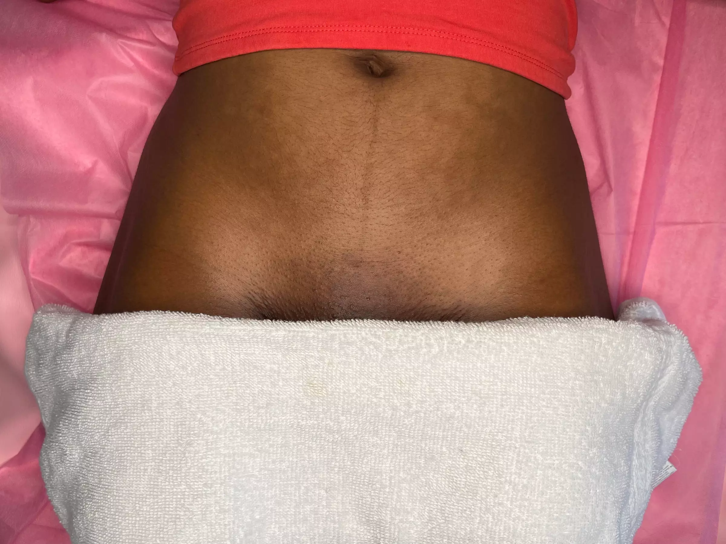 Up to 67% Off on Brazilian / Bikini Waxing at Sugared & Browed