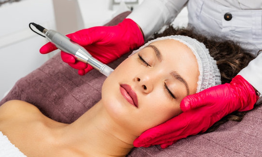 Image 1: Revitalize skin w/ Collagen Induction w/ Exosomes, PRP or  LED Therapy