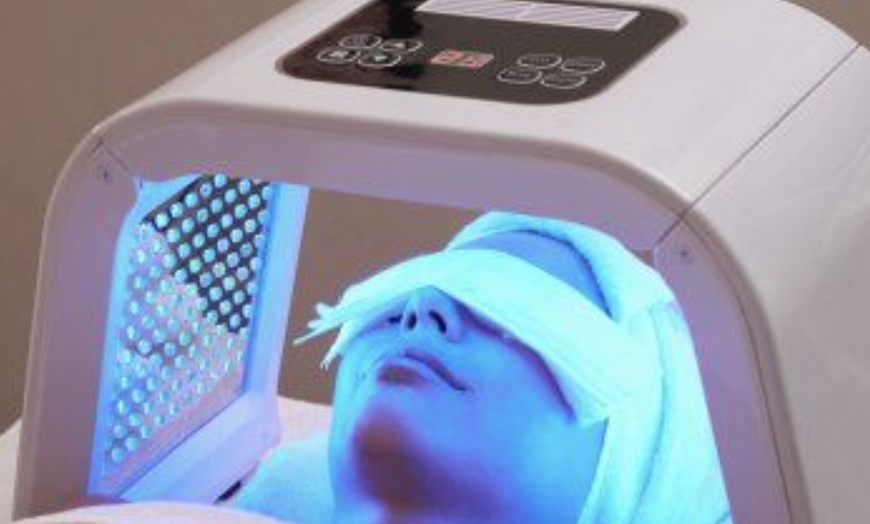 Image 2: IPL, Carbon Laser, RF Lifting or Micro-needling Facial Sessions