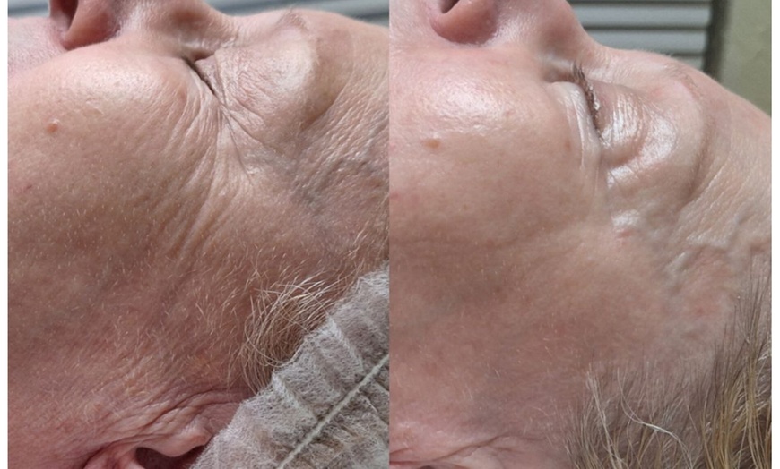 Image 3: Bis zu 35% Rabatt auf den Massage – Aromaöl bei Gym for skin Kosmetiksalon