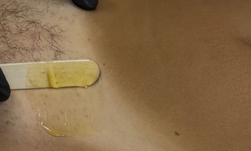 Image 3: Brazilian & Underarm Waxing with Aftercare Kit or  Two Underarm Waxes