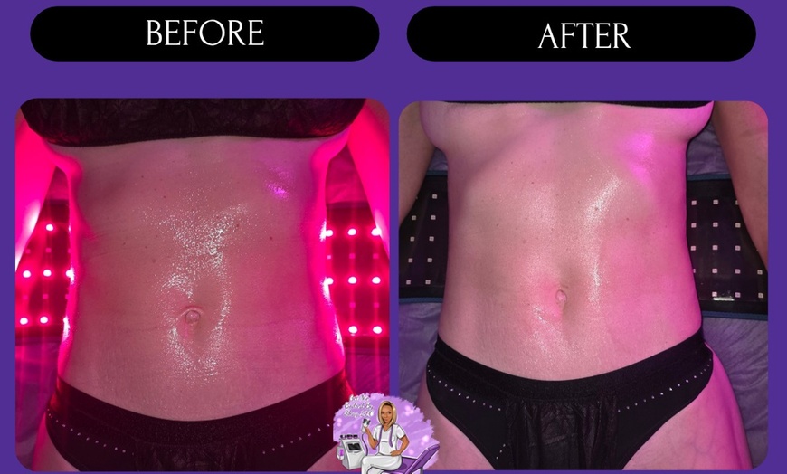 Image 4: 1 or 3 60-Min Lymphatic Drainage Massages with Optional Wood Therapy