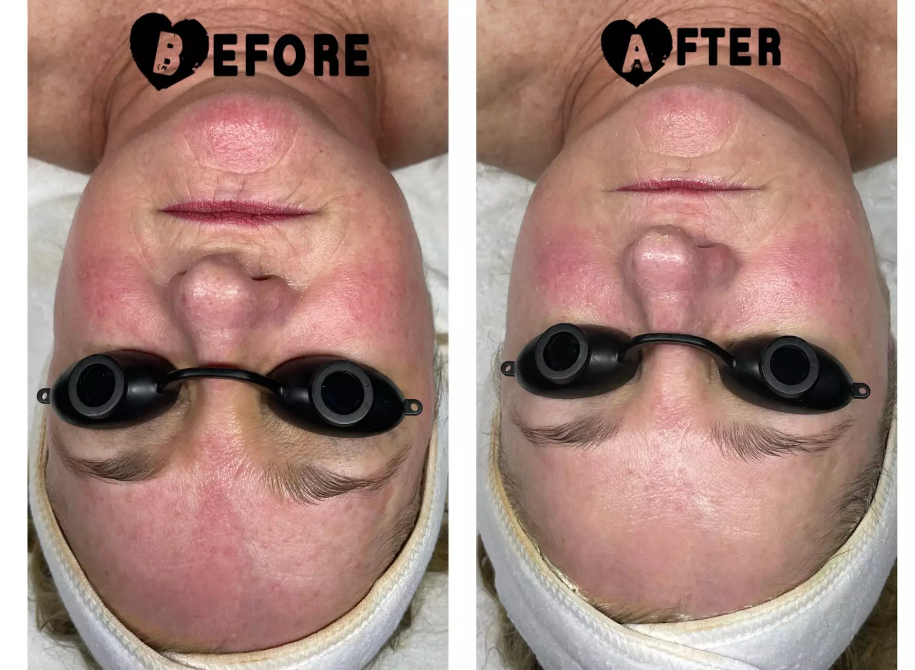 At Be Bare Skin, experience up to 50% off on a variety of facial options including a custom facial and enzyme DMK treatments - Second Medium