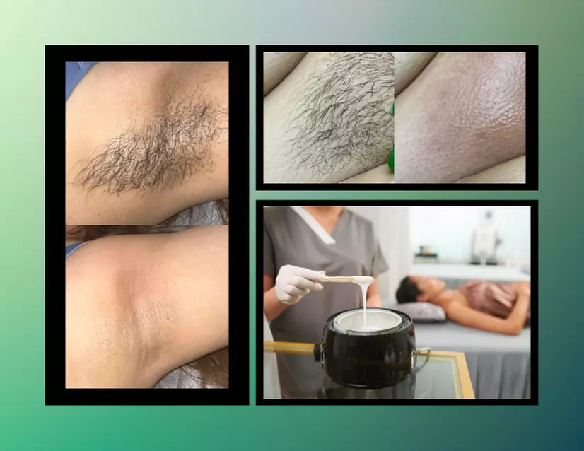 Brazilian and Underarm Wax Combo or Brazilian and Full Butt Wax at The Diamond Complexion (Up to 50% Off) - Primary Image