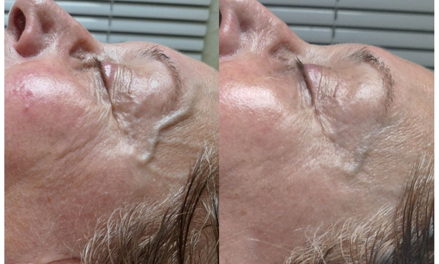 Image 5: Bis zu 35% Rabatt auf den Massage – Aromaöl bei Gym for skin Kosmetiksalon